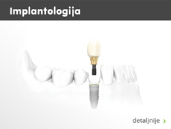 implantologija