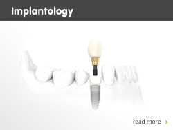 Implantology