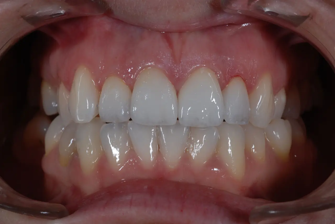 Dedent Stomatolog Beograd